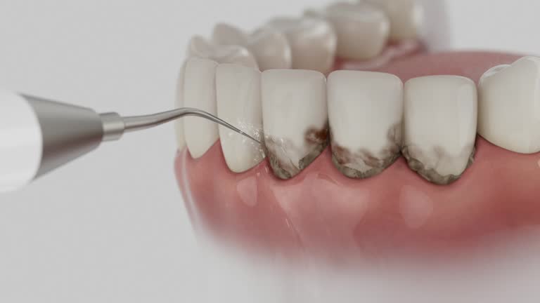 Trusted Dental Crowns And Bridges service in Brilliant, OH - Dentist Open Now